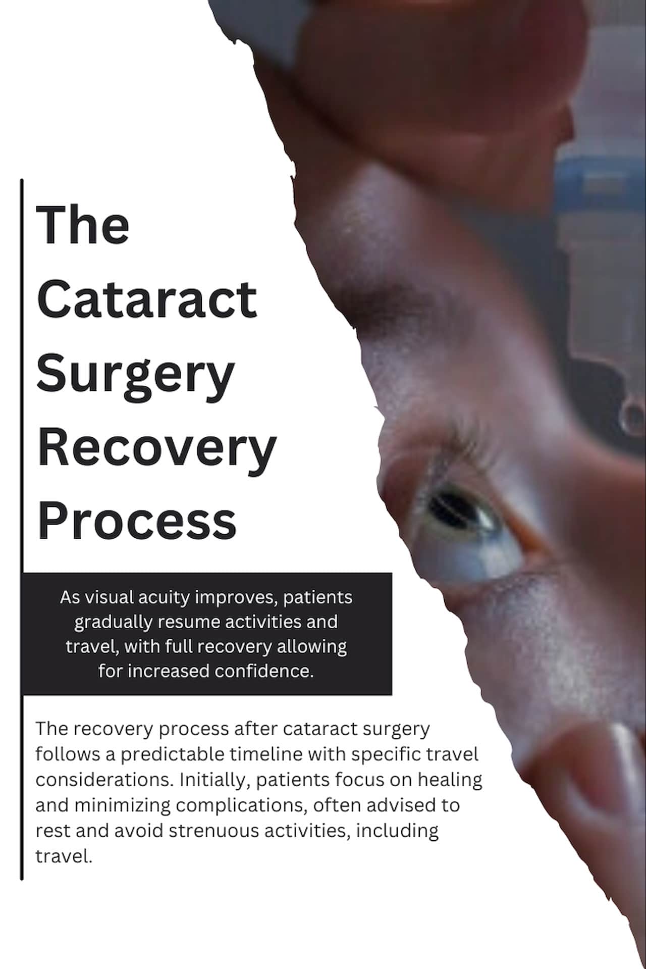 The Cataract Surgery Recovery Process